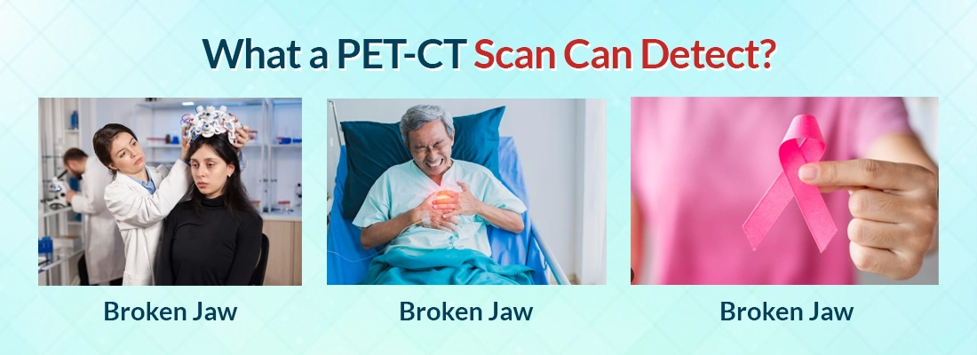 What a PET-CT Scan Can Detect